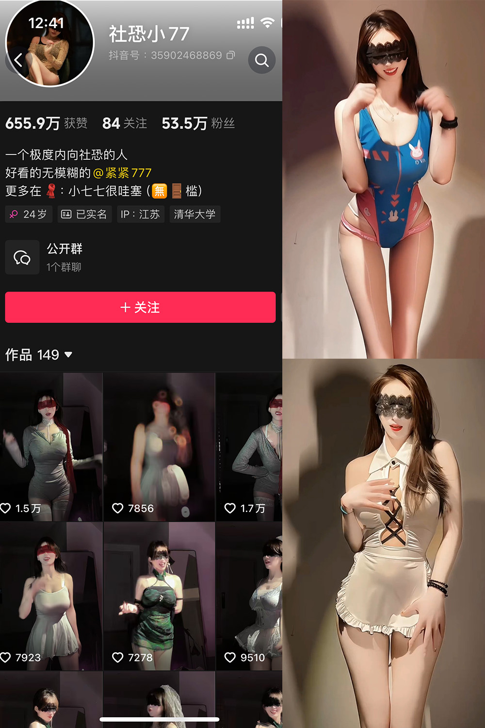 抖音 社恐小77 微密圈 002期 【20V】最新至:2025.3.11