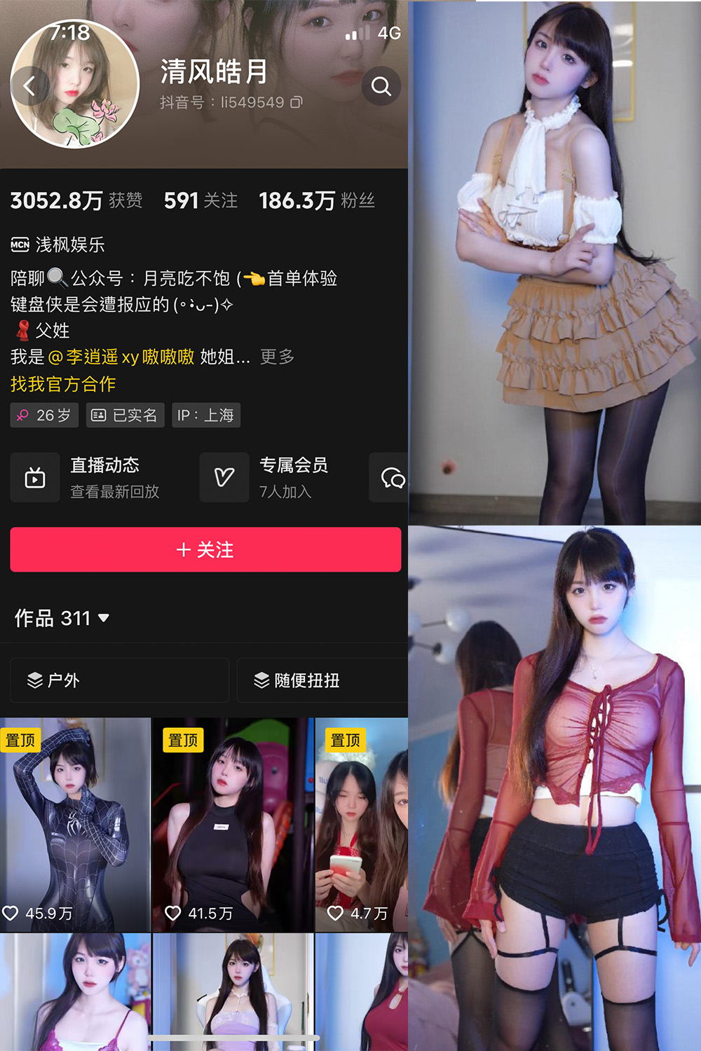 抖音 清风皓月 微密圈 NO.001期 【31P14V】